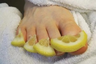 The lemon from the nail fungus