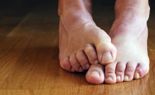 Causes of fungal defeat nail