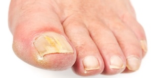 flexible nail Polish on the feet