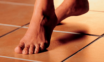 Walking barefoot as a cause of fungus on the skin of the feet