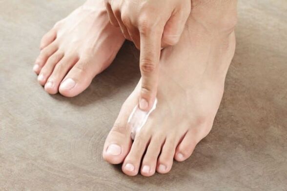Apply ointment from the skin fungus on the feet