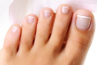 fungus of the nails in the feet